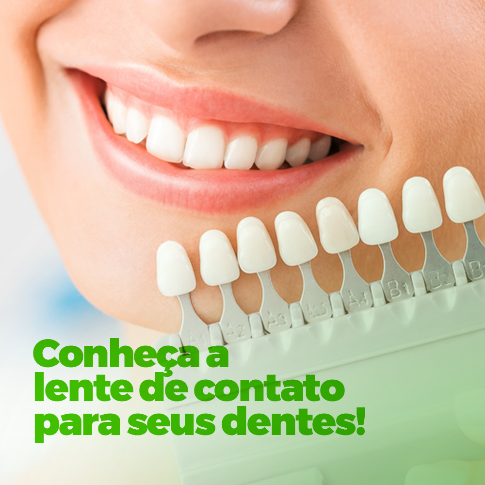 Lente de contato dental: como melhorar o seu sorriso de uma vez por todas?