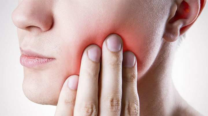 Veja porque avaliar o Dente Siso